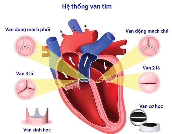 Bệnh lý tim mạch: Có những loại bệnh van tim nào?