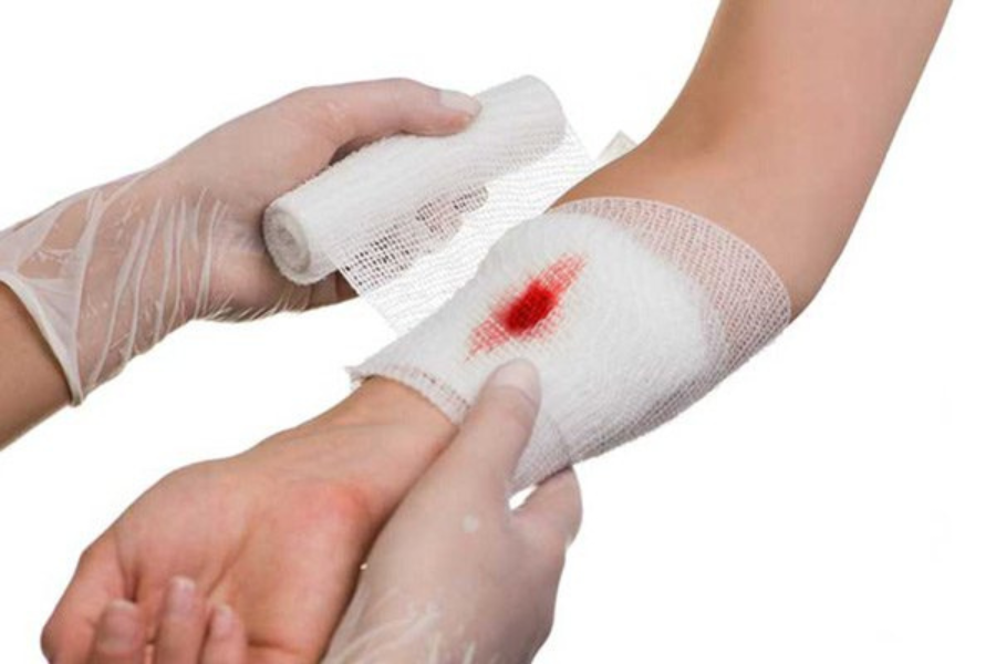 Chảy máu nhiều lần ở khớp và cơ theo thời gian có thể gây ra tổn thương vĩnh viễn