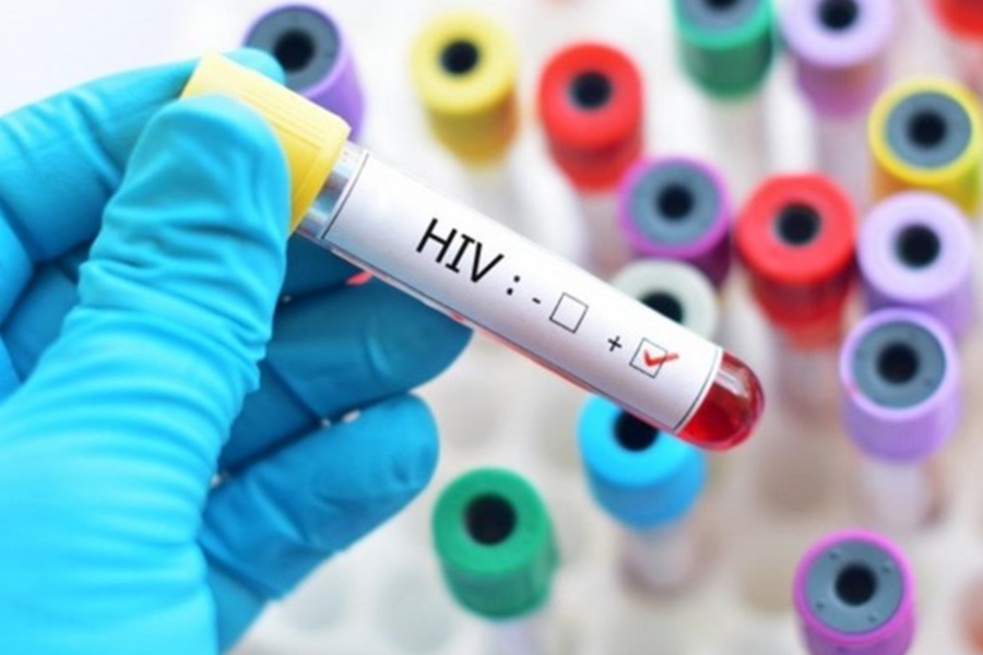 HIV/AIDS là một trong những nguyên nhân gây suy giảm miễn dịch của người bệnh