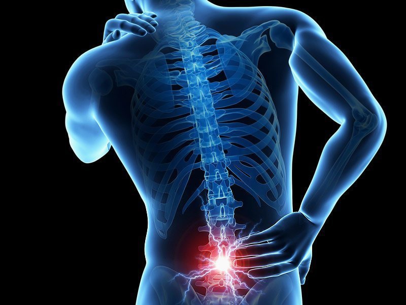Các nguyên nhân thường gặp trong hội chứng đau thắt lưng- hông