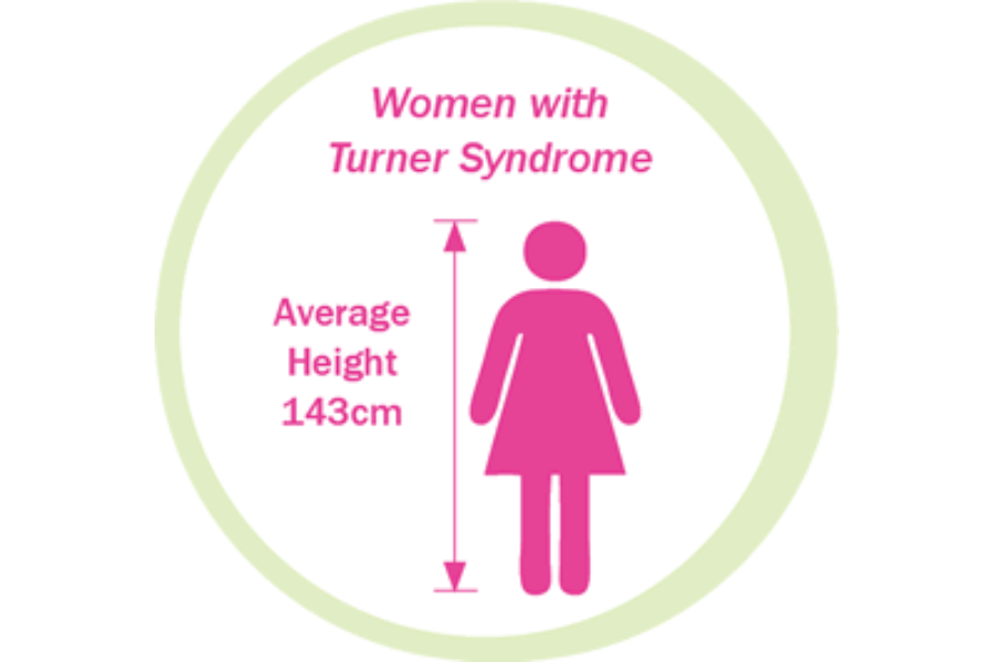 Hầu hết các bé gái mắc hội chứng Turner đều thấp hơn các bạn cùng tuổi