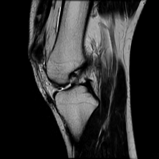 Chụp MRI các khớp