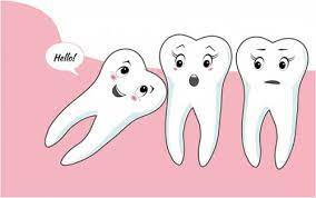 Mọc răng khôn có ý nghĩa gì? Có nên nhổ răng khôn không?