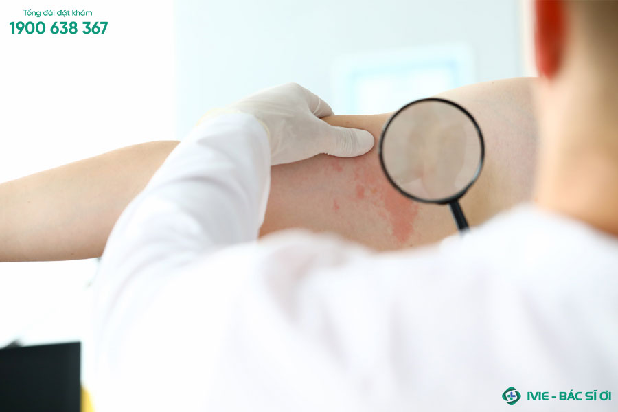 Khi gặp phải các triệu chứng của các bệnh về da bạn cần thăm khám với bác sĩ để được tư vấn và điều trị