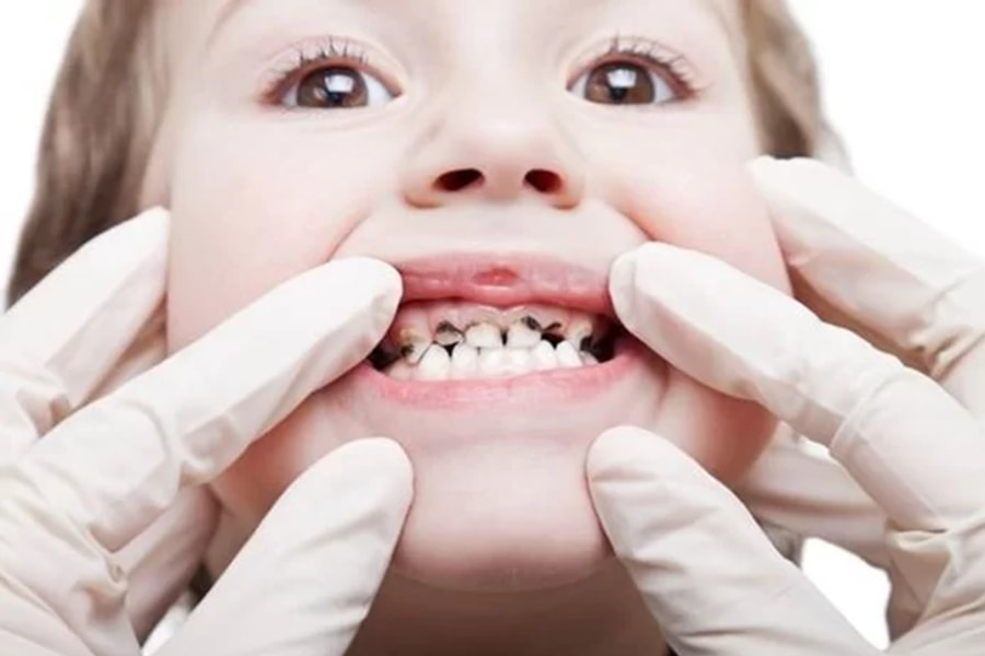Khám răng định kỳ sẽ giúp bạn phát hiện sớm các mầm bệnh 