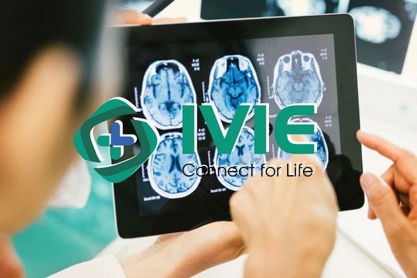 Khám thần kinh Bệnh viện Hữu nghị Việt Đức cần lưu ý gì?