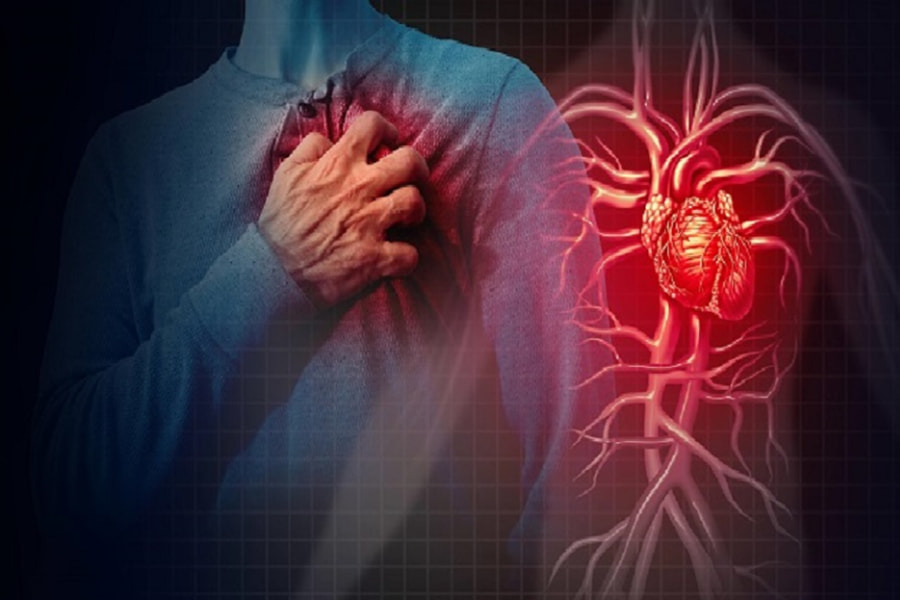 Nhồi máu cơ tim - bệnh lý tim mạch nguy hiểm 
