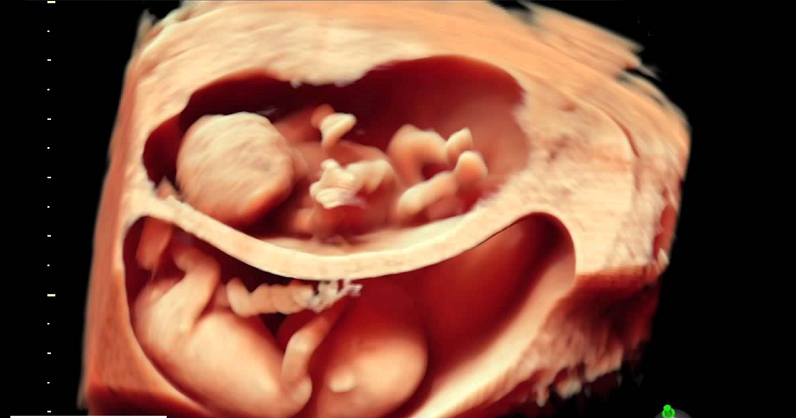 Siêu âm doppler trong thai kì và những điều cần biết