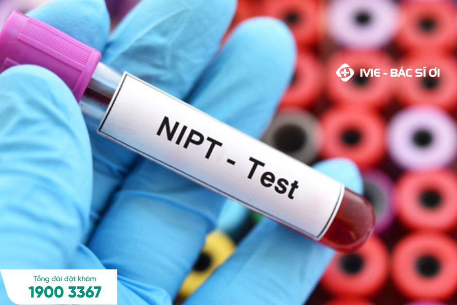 Làm Double Test rồi có cần làm NIPT không?