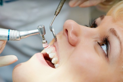 Tẩy trắng răng kết hợp - Phòng khám Nha khoa CDENTAL