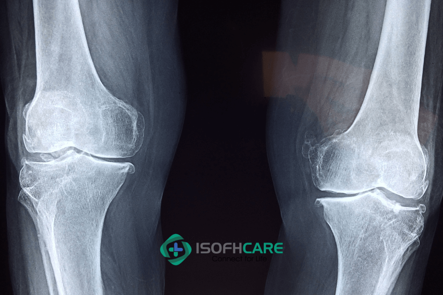 Siêu âm, X Quang, chụp Cộng hưởng từ, chụp Cắt lớp vi tính… 