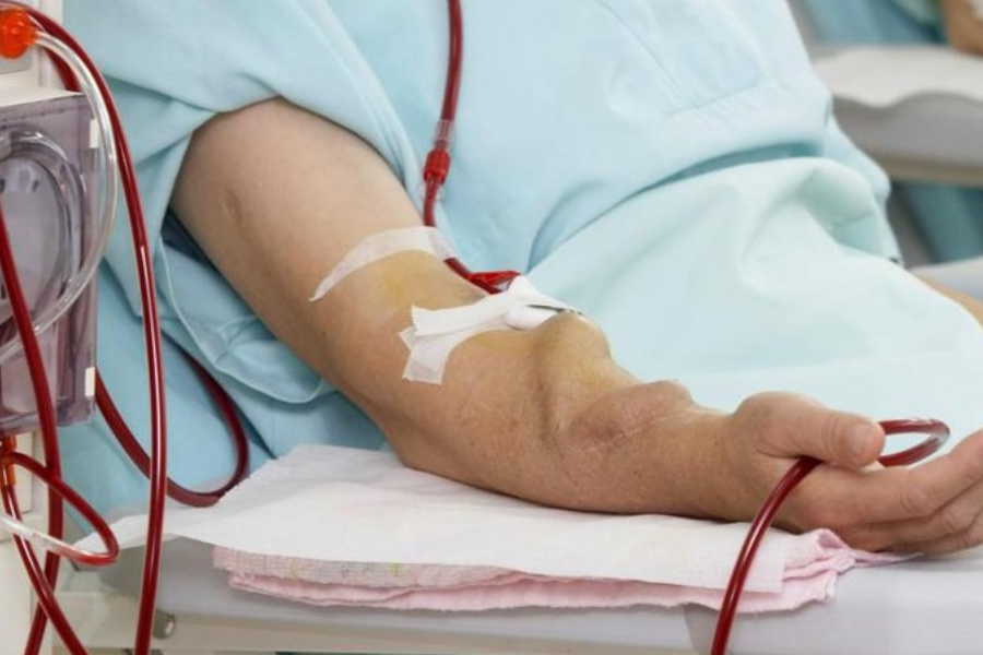 Bệnh nhân lọc máu chu kỳ vì suy thận giai đoạn cuối