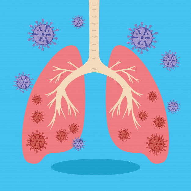 Bệnh viêm phổi: Nguyên nhân, triệu chứng, phân loại