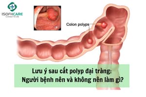 Lưu ý sau cắt polyp đại tràng: Người bệnh nên và không nên...