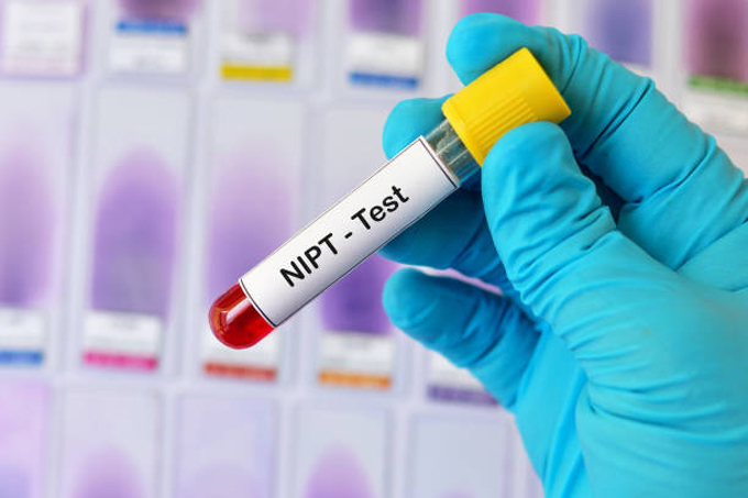 Xét nghiệm trước sinh không xâm lấn NIPT - Trisure 3