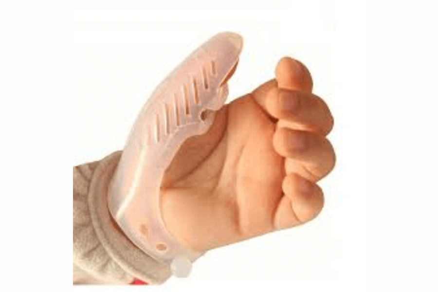 Điều trị giúp loại bỏ thói quen mút ngón tay