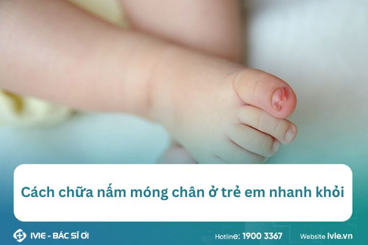 Cách chữa nấm móng chân ở trẻ em nhanh khỏi
