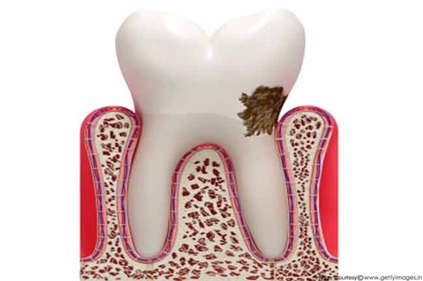Nguyên nhân gây ra vấn đề về răng miệng