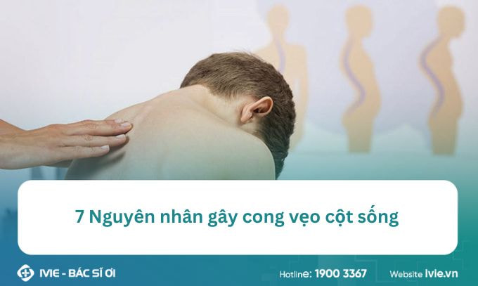 7 Nguyên nhân gây cong vẹo cột sống và các giải pháp hiệu...