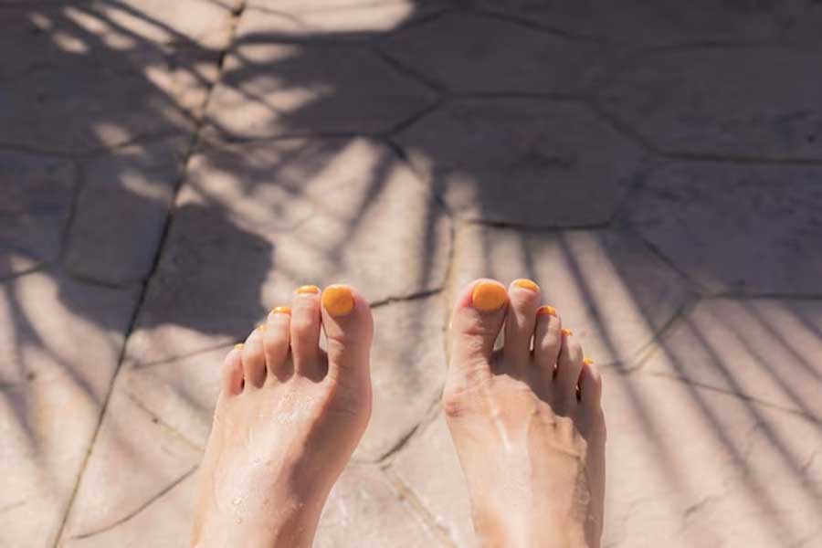 Nguyên nhân xuất hiện đốm nâu trên da chân chủ yếu là do tác động của ánh nắng mặt trời
