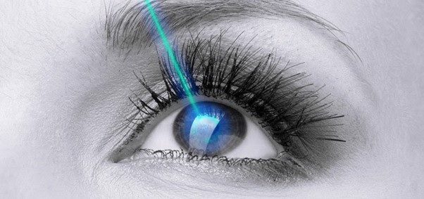 Những ai nên mổ mắt cận thị? Những lưu ý sau mổ
