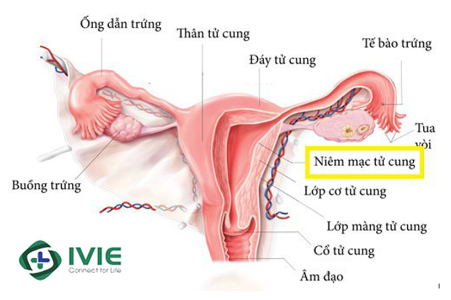  Niêm mạc tử cung (còn gọi là nội mạc tử cung) là lớp niêm mạc mềm và xốp phủ toàn bộ mặt trong của tử cung