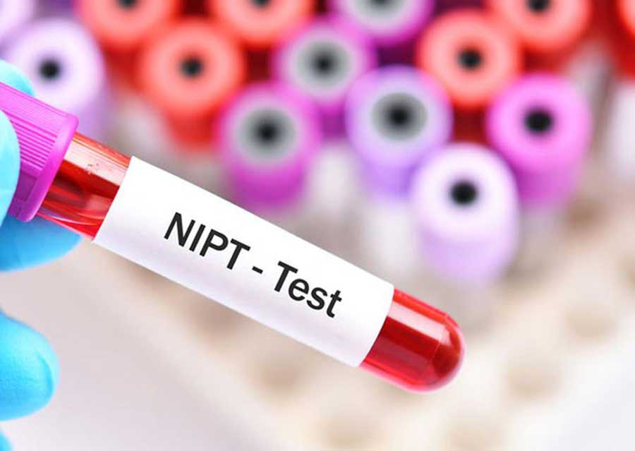 NIPT được thực hiện khi nào trong thai kỳ?