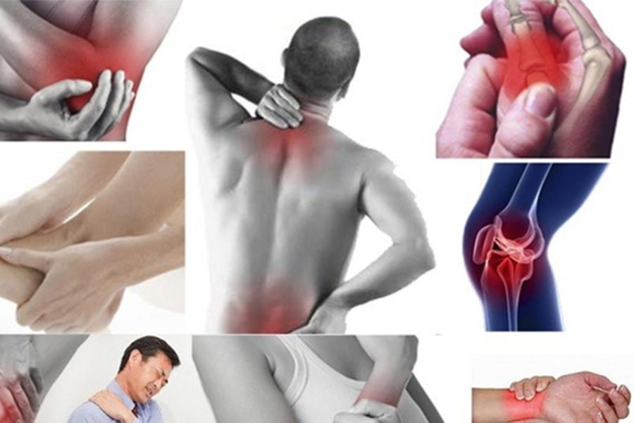  Hình ảnh đau nhức xương khớp