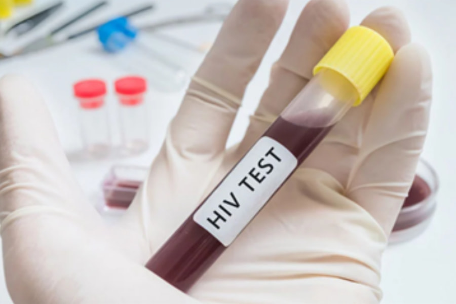 Phòng khám Hải Đăng cung cấp Test HIV