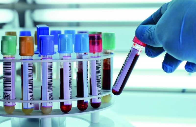 Xét nghiệm Coombs - xác định thiếu máu do tan máu - TTXN MEDICEN