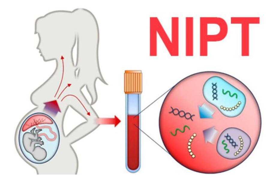 Những thai phụ trên 35 tuổi nên đi xét nghiệm NIPT để sàng lọc bệnh di truyền, dị tật bẩm sinh của thai nhi