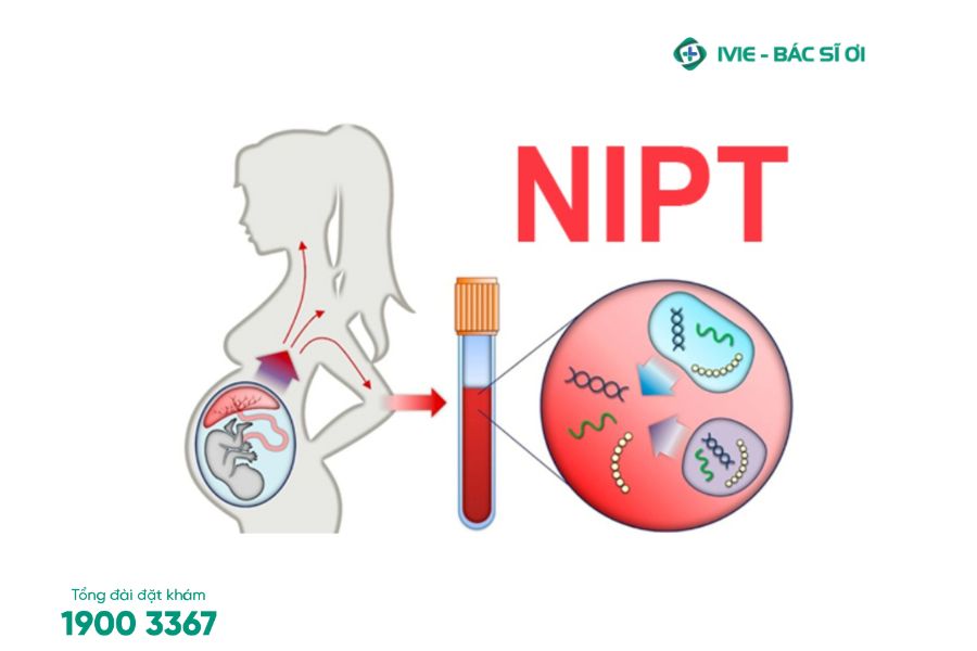 Phương pháp xét nghiệm sàng lọc trước sinh không xâm lấn (NIPT)