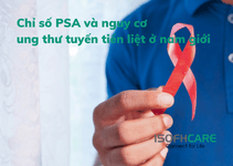 Chỉ số PSA và nguy cơ ung thư tuyến tiền liệt ở nam giới