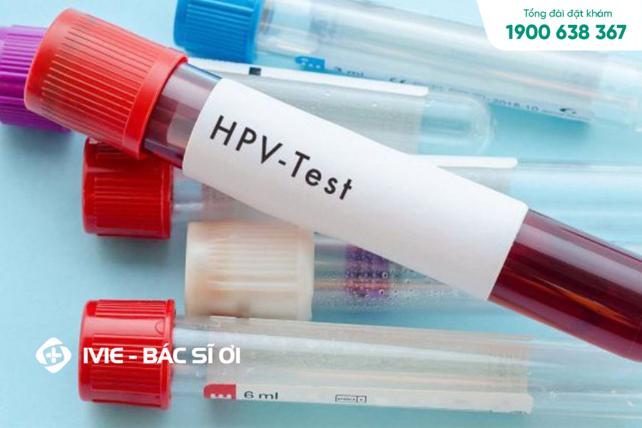 Xét nghiệm HPV có tầm quan trọng như thế nào?