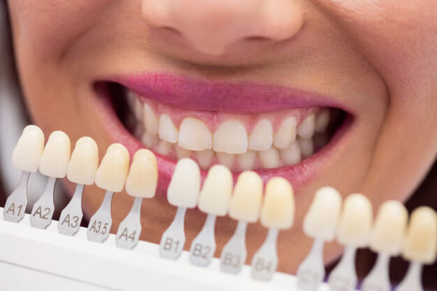 Làm gì khi răng bỗng nhiên bị đổi màu?