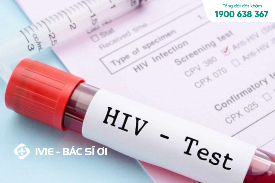 Xét nghiệm HIV là xét nghiệm gì?