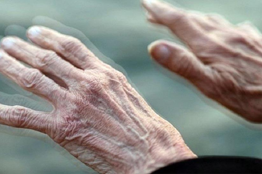 Run tay - Một biểu hiện rối loạn thần kinh cơ ở bệnh nhân Parkinson