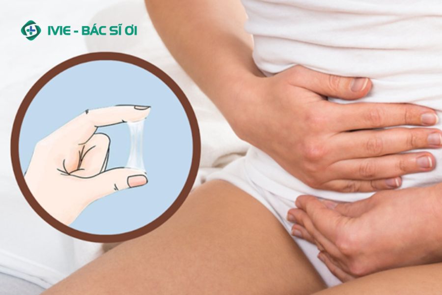 Ra dịch trắng kèm các biểu hiện đau bụng dưới, ngứa rát âm đạo là cảnh báo bệnh phụ khoa
