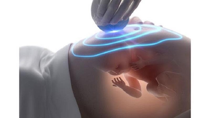 Siêu âm doppler trong thai kì và những điều cần biết