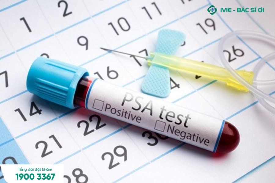 BV Hưng Việt sử dụng xét nghiệm PSA để phát hiện và tầm soát ung thư tuyến tiền liệt