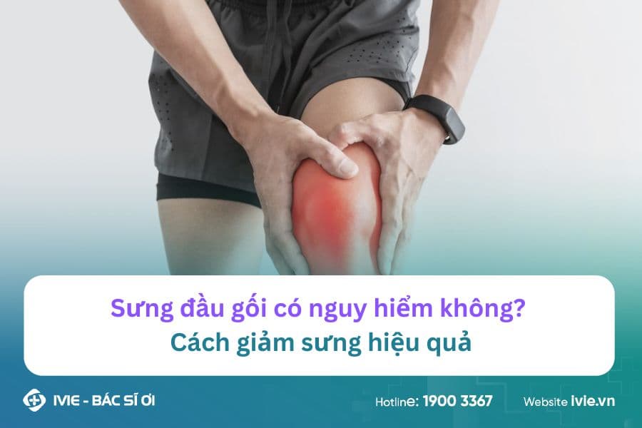 Sưng đầu gối có nguy hiểm không? Cách giảm sưng hiệu quả