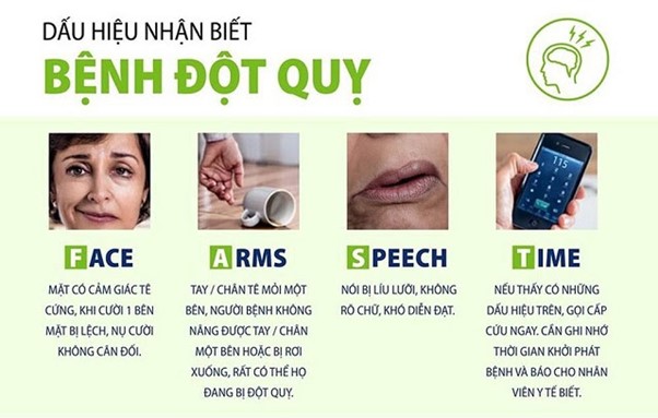 Dấu hiệu tai biến mạch máu não