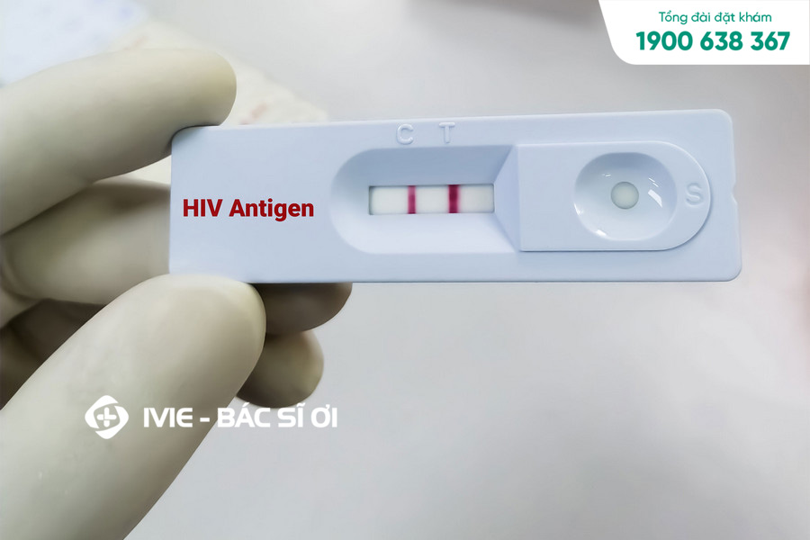Tại sao xét nghiệm HIV phải làm 3 lần? Xét nghiệm HIV bao lâu có kết quả?