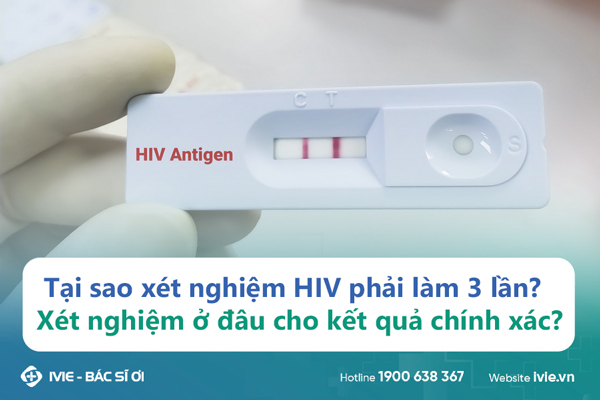Tại sao xét nghiệm HIV phải làm 3 lần? Xét nghiệm ở đâu cho ...