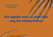 Các phương pháp xét nghiệm ung thư xương hiện nay?
