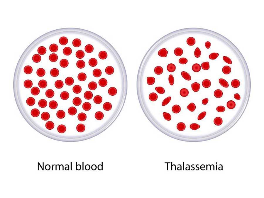 Tổng phân tích tế bào máu ngoại vi