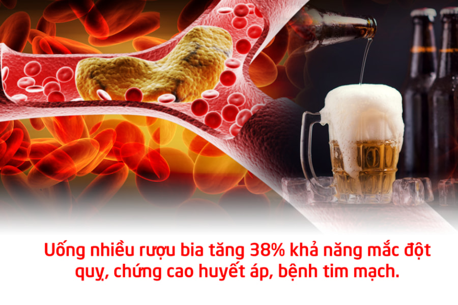 Hạn chế sử dụng rượu bia để làm giảm nguy cơ mắc tăng huyết áp thứ phát nói riêng và bệnh tim mạch nói chung