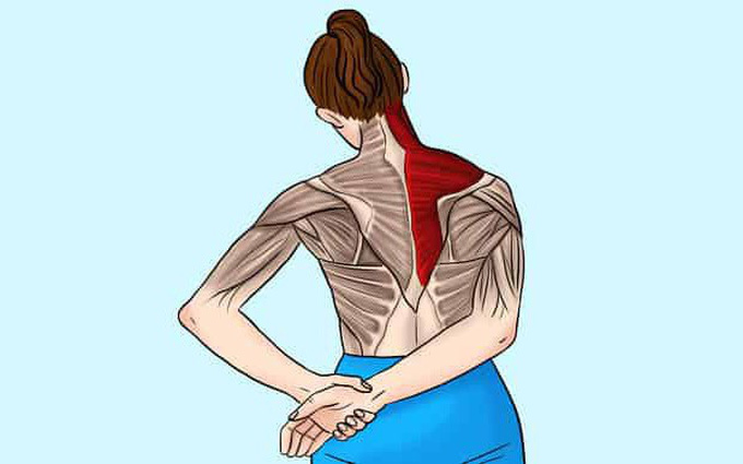 Teo cơ, biến dạng khớp hoặc tàn phế