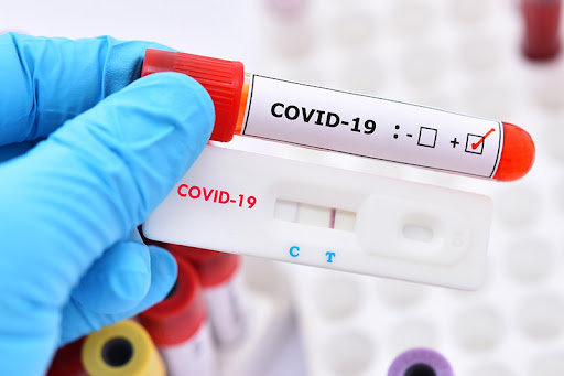Xét nghiệm PCR Covid Gộp 2 - Bệnh viện An Việt