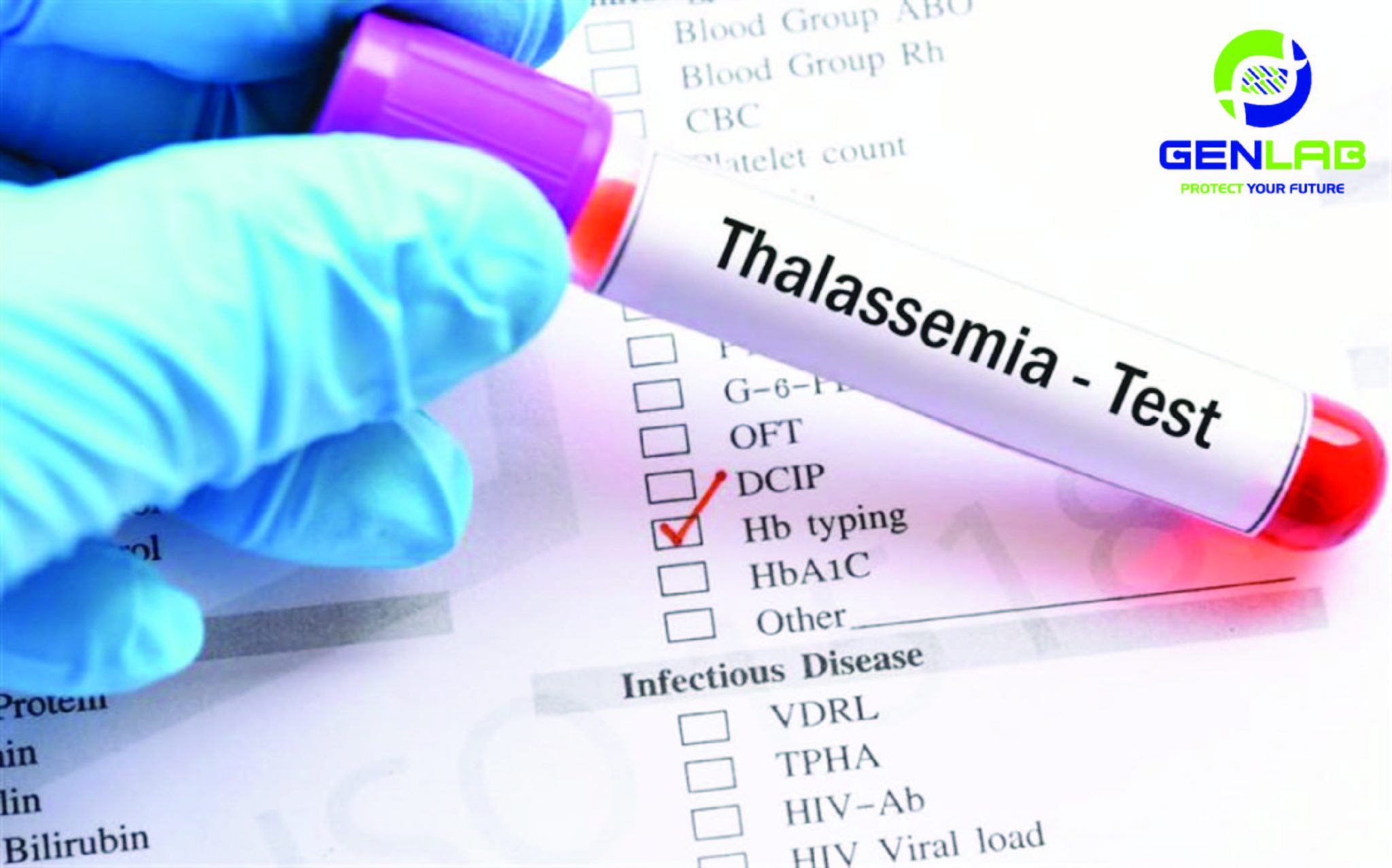 Xét nghiệm tan máu bẩm sinh Thalassemia